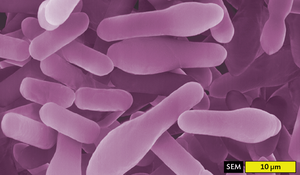 SEM image of Clostridium species showing rod-shaped cells