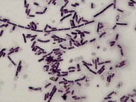 Gram stain of Bacillus species showing rod-shaped cells