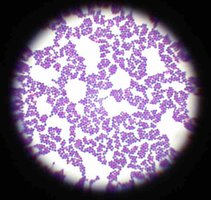 Microscopic image of Staphylococcus aureus clusters