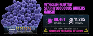Infographic on MRSA (Methicillin-resistant Staphylococcus aureus)