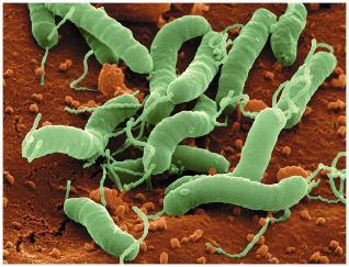 Helicobacter pylori colonizing stomach tissue