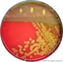 Blood agar plate showing hemolysis