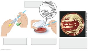 Streak plate technique