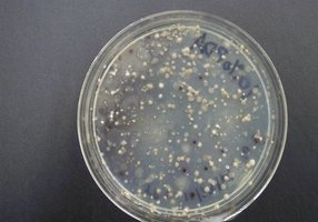 Comparison of viable and microscopic counts
