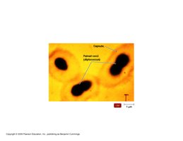 Quellung reaction showing capsule swelling in Haemophilus influenzae