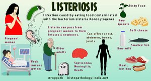 Infographic showing listeriosis transmission and risk groups