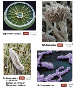 Comparison of types of microscopes: light microscopy