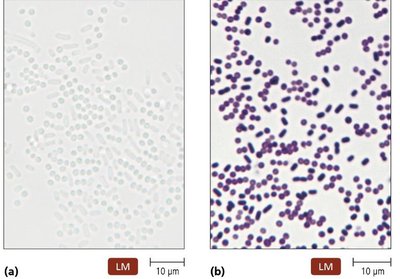 Gram staining procedure