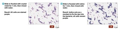Acid-fast stain and endospore stain