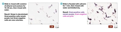 Endospore stain of Bacillus anthracis