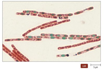Negative (capsule) stain of Klebsiella pneumoniae