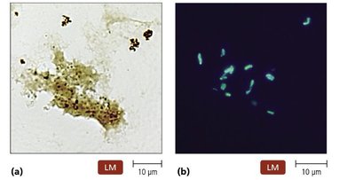 Immunofluorescence microscopy: antibody with fluorescent dye