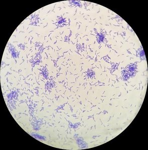 Clear endospores, purple bacterial cells.