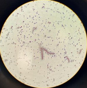 Bacterial capsules. Clear capsules, purple bacilli cells.