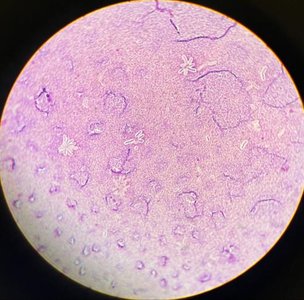 Peritrichous flagella on bacilli. Flagella appears as black hair-like structures around the cell.