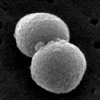 Electron Micrograph of Diplococcus