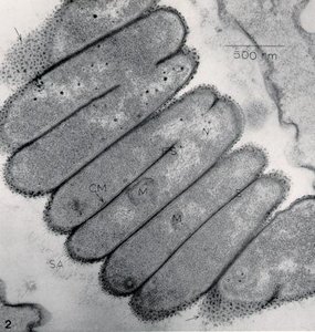 Filamentous bacteria