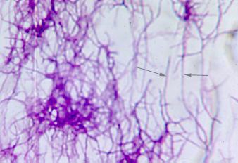 Unusual bacterial morphologies