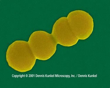 Photomicrograph of Streptococcus pyogenes