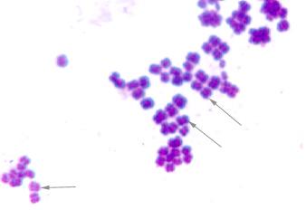 Sarcina arrangement of cocci (colored)