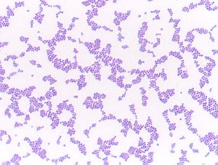 Staphylococcus arrangement of cocci