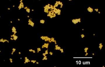 Staphylococcus arrangement of cocci (colored)