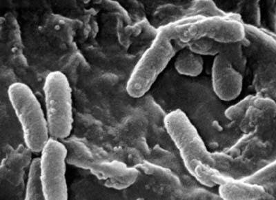 Electron micrograph of rod-shaped bacteria
