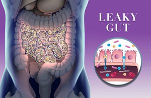 Illustration of leaky gut and its effects on the intestine