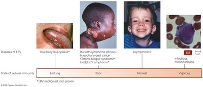 Diseases of EBV and cellular immunity