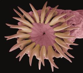 Protist