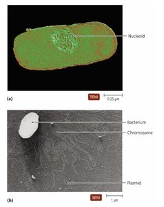 TEM and SEM images of prokaryotic chromosomes and plasmids