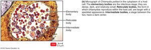 Chlamydia bodies in host cell