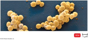 Staphylococcus aureus clusters