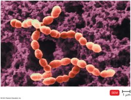 Streptococcus chains