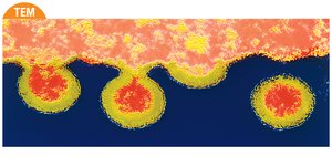 HIV budding from a white blood cell