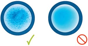 Agglutination test results: positive and negative