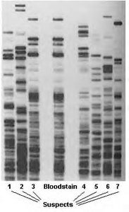 DNA fingerprinting gel showing band patterns