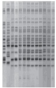 Gel electrophoresis of DNA samples