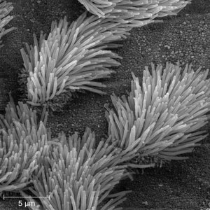 Scanning electron micrograph of ciliated epithelial cells in the trachea