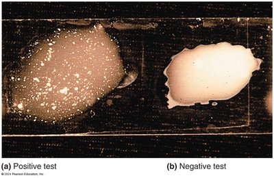 Serological agglutination test: positive and negative results