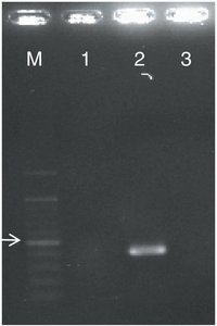 PCR gel electrophoresis for DNA identification