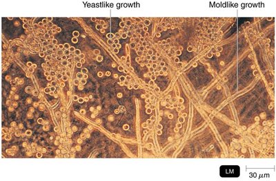 Dimorphic fungus showing yeastlike and moldlike growth