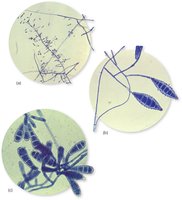 Microscopic view of dermatophytes