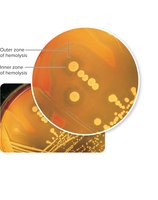 Blood agar showing hemolysis zones