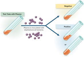 Coagulase test for Staphylococcus aureus