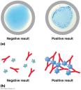 Bacterial colonies on agar plate
