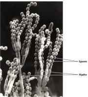 Fungal hyphae and spores