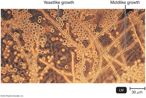 Light micrograph showing yeastlike and moldlike growth (dimorphism)
