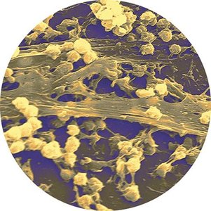 Biofilm on a catheter surface