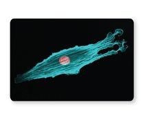 Fluorescence Microscopy